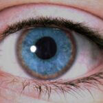 Wilson’s disease