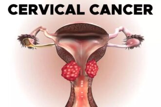 Aiims breakthrough: blood test tracks cervical cancer treatment